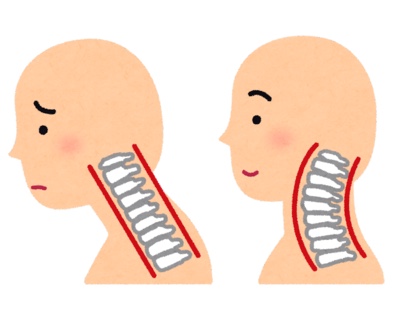 現代病のスマホ首